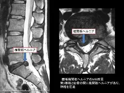 米乐m6-包含国际比赛日拉齐奥备战德甲上海海港今夜战术微调，媒体一致点评：里昂状态回暖备战欧篮联的词条